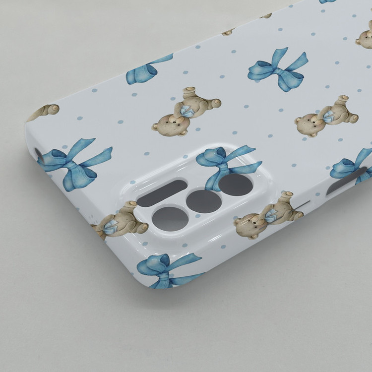 کاور گارد قاب علوی مدل SML مناسب برای گوشی موبایل شیائومی Redmi Note 10 5G